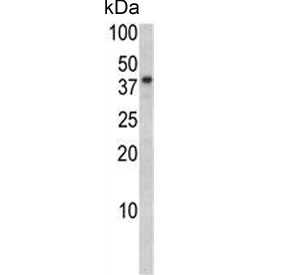 Western blot testing of human SK-BR-3 cell lysate with BGN antibody. Predicted molecular weight ~41 kDa.