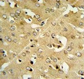 IHC testing of FFPE mouse brain tissue with Corticotropin-releasing factor receptor 2 antibody. HIER: steam section in pH6 citrate buffer for 20 min and allow to cool prior to staining.