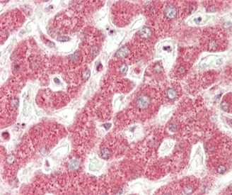 IHC testing of FFPE human liver tissue with NADH-ubiquinone oxidoreductase chain 5 antibody. HIER: steam section in pH6 citrate buffer for 20 min and allow to cool prior to staining.