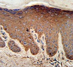 IHC testing of FFPE human skin tissue with Pyruvate Kinase PKM antibody. HIER: steam section in pH6 citrate buffer for 20 min and allow to cool prior to staining.