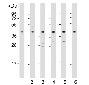 Western blot testing of 1) human HepG2, 2) human HeLa, 3) rat PC-12, 4) human Jurkat, 5) human MCF7 and 6) mouse kidney lysate with p38 MAPK antibody. Expected molecular weight: 38-41 kDa.