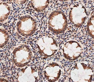 IHC testing of FFPE human colon tissue with Prohibitin 2 antibody. HIER: steam section in pH9 EDTA buffer for 20 min and allow to cool prior to staining.