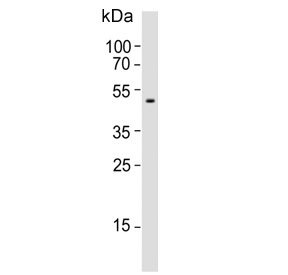 Western blot testing of human blood plasma lysate with Pigment epithelium-derived factor antibody. Predicted molecular weight ~46 kDa.