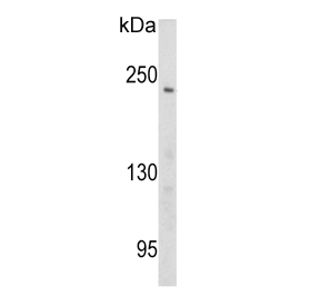 Western blot testing of human Ramos cell lysate with Pericentriolar material 1 protein antibody. Predicted molecular weight ~229 kDa.