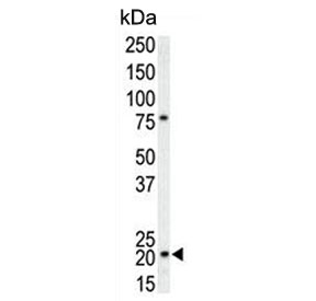 Western blot testing of human T-47D cell lysate with p21WAF1 antibody. Expected molecular weight: 18-21 kDa.