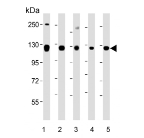 Western blot testing of human 1) HeLa, 2) K562, 3) NCCIT, 4) SH-SY5Y and 5) T-47D cell lysate with ROR2 antibody. Expected molecular weight: 105-130 kDa.