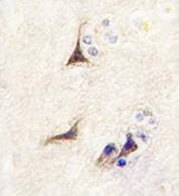 IHC testing of FFPE human brain tissue with Beta-nerve growth factor antibody. HIER: steam section in pH6 citrate buffer for 20 min and allow to cool prior to staining.