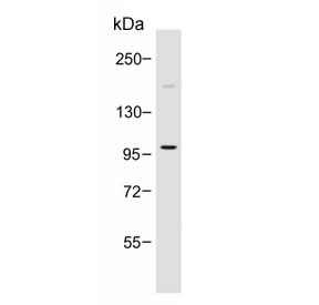 Western blot testing of human HT-1080 cell lysate with PI3K delta antibody. Expected molecular weight: 110-120 kDa.