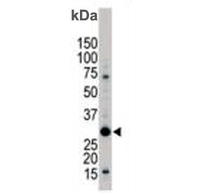 Western blot testing of human Jurkat cell lysate with YWHAB antibody. Predicted molecular weight ~28 kDa.