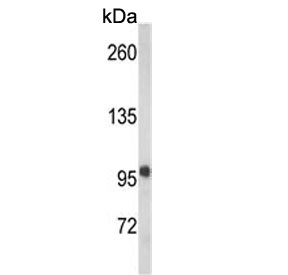 Western blot testing of mouse brain tissue lysate with VPS53 antibody. Predicted molecular weight ~94 kDa.