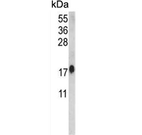 Western blot testing of human HeLa cell lysate with CALM1 antibody. Predicted molecular weight ~17 kDa.