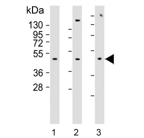 Western blot testing of human 1) MCF7, 2) MDA-MB-231 and 3) SK-BR-3 cell lysate with Alpha-2B Adrenergic Receptor antibody. Predicted molecular weight ~50 kDa.