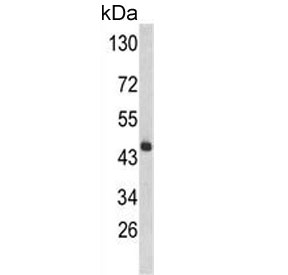 Western blot testing of mouse liver tissue lysate with HPD antibody. Predicted molecular weight ~45 kDa.