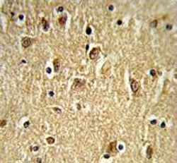 IHC testing of FFPE human brain tissue with PTK2 antibody. HIER: steam section in pH6 citrate buffer for 20 min and allow to cool prior to staining.