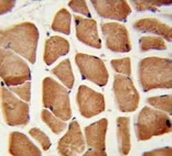 IHC testing of FFPE human skeletal muscle tissue with Enoyl-CoA delta isomerase 2 antibody. HIER: steam section in pH6 citrate buffer for 20 min and allow to cool prior to staining.