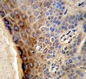 IHC testing of FFPE human skin tissue with CTHRC1 antibody. HIER: steam section in pH6 citrate buffer for 20 min and allow to cool prior to staining.