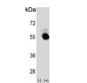 Western blot testing of 1) non-transfected and 2) transfected 293 cell lysate with SELENBP1 antibody.