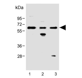 Western blot testing of human 1) CCRF-CEM, 2) ThP-1 and 3) HeLa cell lysate with FCGR1B antibody. Predicted molecular weight: 22-32 kDa but may be observed at higher molecular weights due to glycosylation.