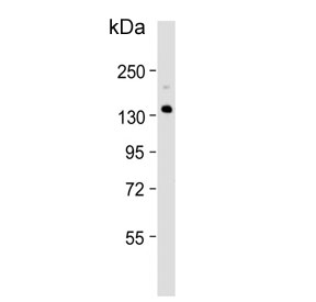 Western blot testing of human fetal liver tissue lysate with XDH antibody. Predicted molecular weight ~146 kDa.