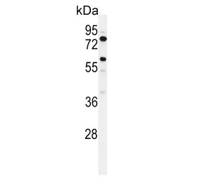 Western blot testing of human K562 cell lysate with ACSBG2 antibody. Expected molecular weight: 75-80 kDa.