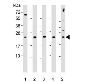 Western blot testing of human 1) WiDr, 2) Raji, 3) K562, 4) Jurkat and 5) CCRF-CEM cell lysate with CTLA4 antibody. Predicted molecular weight ~25 kDa but may be observed at higher molecular weights due to glycosylation.