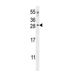 Western blot testing of mouse heart tissue lysate with Claudin 6 antibody.  Predicted molecular weight ~23 kDa.