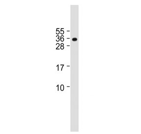 Western blot testing of human U-251 MG cell lysate with BASP1 antibody. Predicted molecular weight ~23 kDa and ~18 kDa (two isoforms). BASP1 may be observed at higher molecular weights due to SUMOylation. The amount of SDS in SDS-PAGE may also affect the observed size.