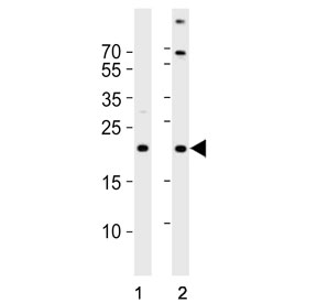 Western blot testing of human 1) MCF7 and 2) A431 cell lysate with TIMM23 antibody. Predicted molecular weight ~22 kDa.