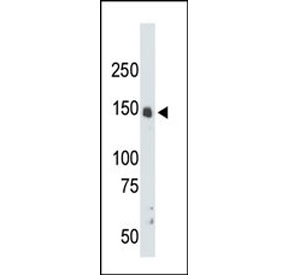 Western blot testing of mouse liver tissue lysate with CrkRS antibody. Predicted molecular weight ~164 kDa.