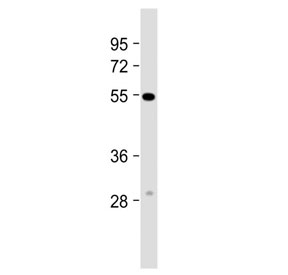 Western blot testing of human heart tissue lysate with CRCL antibody. Predicted molecular weight ~53 kDa.