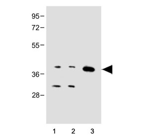 Western blot testing of 1) human Jurkat, 2) human HepG2 and 3) mouse brain tissue lysate with Cx40 antibody. Predicted molecular weight ~40 kDa.