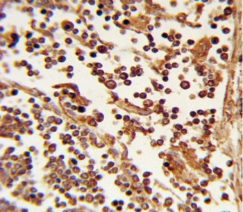 IHC staining of FFPE human lymph tissue with SELL antibody. HIER: steam section in pH6 citrate buffer for 20 min and allow to cool prior to staining.