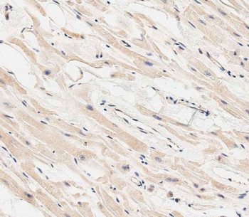 IHC staining of FFPE human heart tissue with MARCH5 antibody. HIER: steam section in pH6 citrate buffer for 20 min and allow to cool prior to staining.