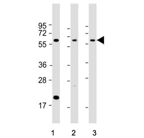 Western blot testing of 1) human PANC-1, 2) mouse cerebellum and 3) rat cerebellum tissue lysate with SLC11A2 antibody. Predicted molecular weight ~63 kDa.