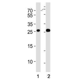 Western blot testing of human 1) Jurkat and 2) A431 cell lysate with RAB29 antibody. Predicted molecular weight ~23 kDa.