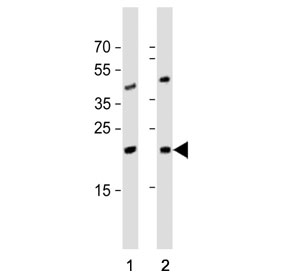 Western blot testing of 1) human Jurkat and 2) mouse testis tissue lysate with ORMDL3 antibody. Predicted molecular weight ~17 kDa.
