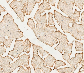IHC staining of FFPE human skeletal muscle tissue with PFKFB4 antibody. HIER: steam section in pH6 citrate buffer for 20 min and allow to cool prior to staining.