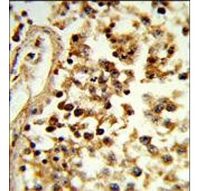 IHC staining of FFPE human testis tissue with IL-31 antibody. HIER: steam section in pH6 citrate buffer for 20 min and allow to cool prior to staining.