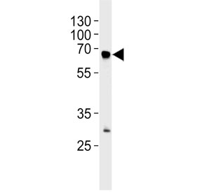 Western blot testing of human blood plasma lysate with Fibrinogen alpha antibody. Predicted molecular weight ~70 kDa (alpha isoform), ~95 kDa (alpha-E isoform).