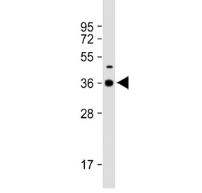 Western blot testing of rat spleen tissue lysate with DNASE1L3 antibody. Predicted molecular weight ~36 kDa.