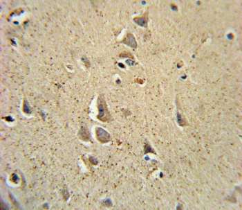 IHC staining of FFPE human brain tissue with SCN1B antibody. HIER: steam section in pH6 citrate buffer for 20 min and allow to cool prior to staining.