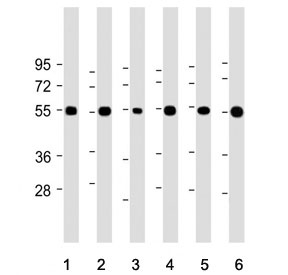 Western blot testing of 1) human brain, 2) human cerebellum, 3) human U-87 MG, 4) mouse brain, 5) mouse Neuro-2a and 6) rat brain tissue lysate with FOXN1 antibody. Predicted molecular weight ~50 kDa.