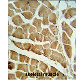 IHC staining of FFPE human skeletal muscle tissue with CAPN3 antibody. HIER: steam section in pH6 citrate buffer for 20 min and allow to cool prior to staining.