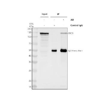 Immunoprecipitating ERC1 in Hela whole cell lysate. Western blot analysis of ERC1 using anti-ERC1 antibody. Lane 1: Hela whole cell lysates (30ug), Lane 2: Rabbit control IgG instead of anti-ERC1 antibody in Hela whole cell lysate, Lane 3: anti-ERC1 antibody (2ug) + Hela whole cell lysate (500ug). After electrophoresis, proteins were transferred to a membrane. Then the membrane was incubated with rabbit anti-ERC1 antibody at a dilution of 0.5 ug/ml and probed with a goat anti-rabbit IgG-HRP secondary antibody. The signal is developed using ECL Plus Western Blotting Substrate. The expected band size for ERC1 is at 128 kDa.