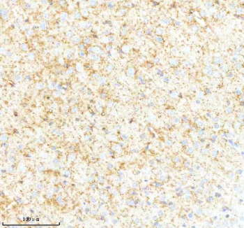 IHC analysis of SYNPR using anti-SYNPR antibody. SYNPR was detected in a paraffin-embedded section of mouse brain tissue. Heat mediated antigen retrieval was performed in EDTA buffer (pH 8.0, epitope retrieval solution). The tissue section was blocked with 10% goat serum. The tissue section was then incubated with 2 ug/ml rabbit anti-SYNPR antibody overnight at 4oC. Peroxidase Conjugated Goat Anti-rabbit IgG was used as secondary antibody and incubated for 30 minutes at 37oC. The tissue section was developed using an HRP secondary and DAB substrate.