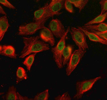 Immunofluorescent staining of SPO11 using anti-SPO11 antibody (green) and anti-Beta Tubulin antibody (red). SPO11 was detected in an immunocytochemical section of Hela cells. Enzyme antigen retrieval was performed using IHC enzyme antigen retrieval reagent for 15 mins. The cells were blocked with 10% goat serum. And then incubated with 5 ug/ml rabbit anti-SPO11 antibody and mouse anti-Beta Tubulin antibody overnight at 4oC. DyLight 488 Conjugated Goat Anti-Rabbit IgG and Cy3 Conjugated Goat Anti-Mouse IgG were used as secondary antibody at 1:500 dilution and incubated for 30 minutes at 37oC. Visualize using a fluorescence microscope and filter sets appropriate for the label used.