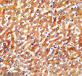 IHC analysis of SLC46A3 using anti-SLC46A3 antibody. SLC46A3 was detected in a paraffin-embedded section of human liver tissue. Heat mediated antigen retrieval was performed in EDTA buffer (pH 8.0, epitope retrieval solution). The tissue section was blocked with 10% goat serum. The tissue section was then incubated with 2 ug/ml rabbit anti-SLC46A3 antibody overnight at 4oC. Peroxidase Conjugated Goat Anti-rabbit IgG was used as secondary antibody and incubated for 30 minutes at 37oC. The tissue section was developed using an HRP secondary and DAB substrate.