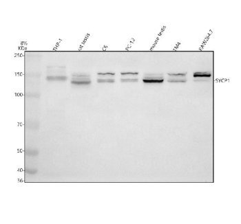Western blot analysis of SYCP1 using anti-SYCP1 antibody. Electrophoresis was performed on a 8% SDS-PAGE gel at 80V (Stacking gel) / 120V (Resolving gel) for 2 hours. Lane 1: human THP-1 whole cell lysates, Lane 2: rat testis tissue lysates, Lane 3: rat C6 whole cell lysates, Lane 4: rat PC-12 whole cell lysates, Lane 5: mouse testis tissue lysates, Lane 6: mouse TM4 whole cell lysates, Lane 7: mouse RAW264.7 whole cell lysates. After electrophoresis, proteins were transferred to a nitrocellulose membrane at 150 mA for 50-90 minutes. Blocked the membrane with 5% non-fat milk/TBS for 1.5 hour at RT. The membrane was incubated with rabbit anti-SYCP1 antibody at 0.5 ug/ml overnight at 4oC, then washed with TBS-0.1%Tween 3 times with 5 minutes each and probed with a goat anti-rabbit IgG-HRP secondary antibody at a dilution of 1:5000 for 1.5 hour at RT. The signal was developed using an ECL Plus Western Blotting Substrate. Expected size for full-length SYCP1 ~114âkDa. In our tumor-cellâline lysates we detect a band at ~120-130âkDa and an additional band at ~150âkDa. The ~120-130âkDa band aligns with literature; the ~150âkDa band may represent a modified, aggregated or altered form of SYCP1 and has not been widely documented in published Western blots for SYCP1.