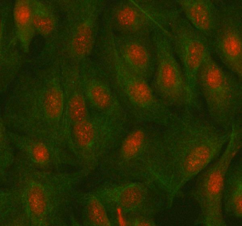 Immunofluorescent staining of MAZ using anti-MAZ antibody (red) and anti-Beta Tubulin antibody (green). MAZ was detected in immunocytochemical section of cell. Enzyme antigen retrieval was performed using IHC enzyme antigen retrieval reagent for 15 mins. The cells were blocked with 10% goat serum. And then incubated with 5 ug/ml rabbit anti-MAZ antibody and mouse anti-Beta Tubulin antibody overnight at 4oC. Cy3 Conjugated Goat Anti-Rabbit IgG and DyLight 488 Conjugated Goat Anti-Mouse IgG were used as secondary antibody at 1:500 dilution and incubated for 30 minutes at 37oC. Visualize using a fluorescence microscope and filter sets appropriate for the label used.
