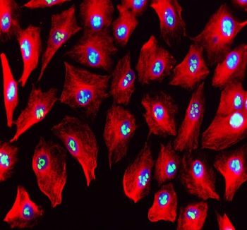 Immunofluorescent analysis of MYBBP1A using anti-MYBBP1A antibody (green) and anti-Beta Tubulin antibody (red). MYBBP1A was detected in an immunocytochemical section of cells. Enzyme antigen retrieval was performed using IHC enzyme antigen retrieval reagent for 15 mins. The cells were blocked with 10% goat serum. And then incubated with 5 ug/ml rabbit anti-MYBBP1A antibody and mouse anti-Beta Tubulin antibody overnight at 4oC. DyLight 488 Conjugated Goat Anti-Rabbit IgG and Cy3 Conjugated Goat Anti-Mouse IgG were used as secondary antibody at 1:500 dilution and incubated for 30 minutes at 37oC. The section was counterstained with DAPI (blue). Visualize using a fluorescence microscope and filter sets appropriate for the label used.